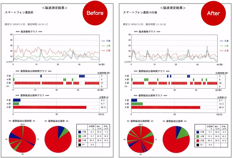 脳波測定試験　結果報告書（ビフォーアフター）