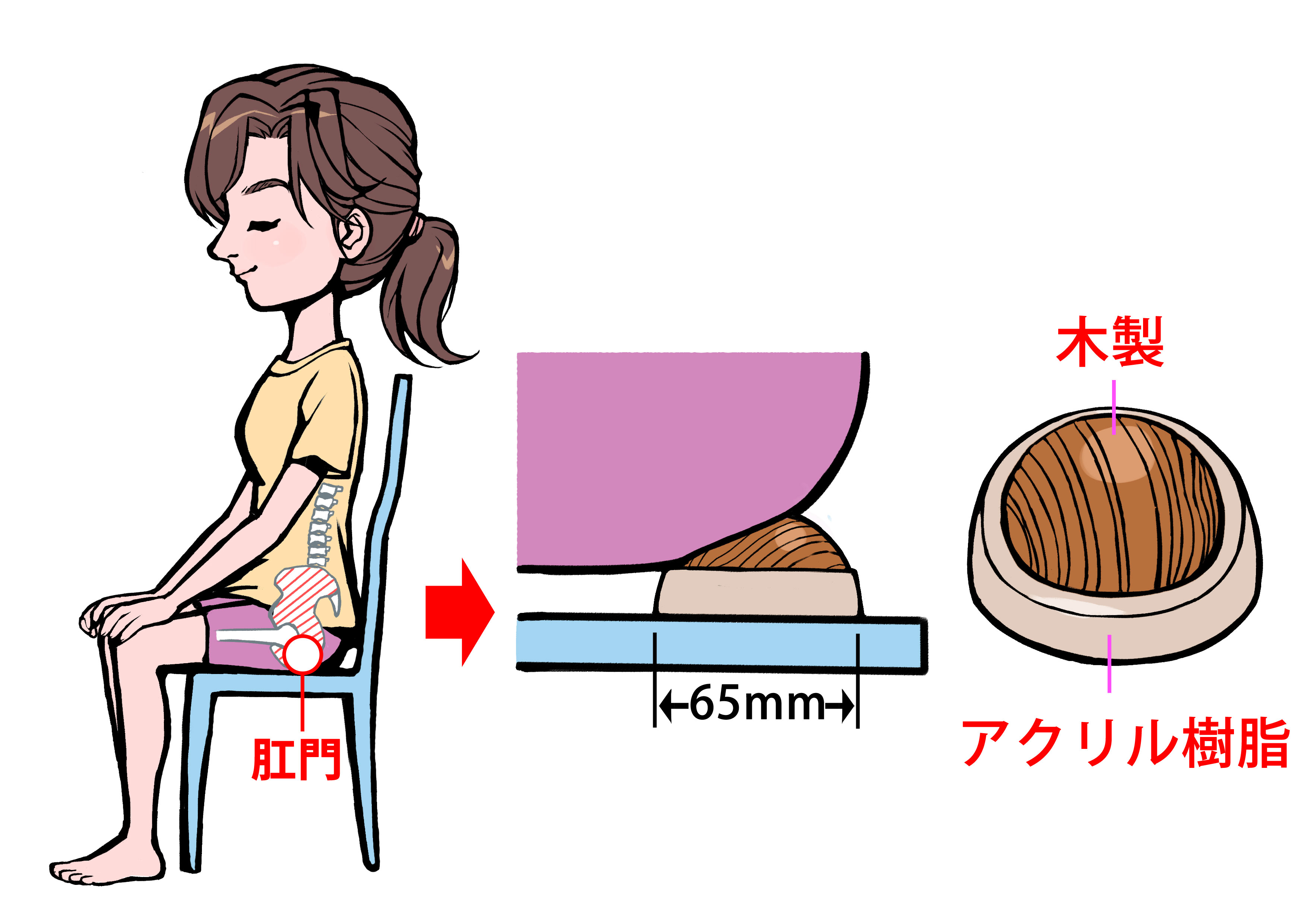 ヒップキュットの上に肛門を乗せる