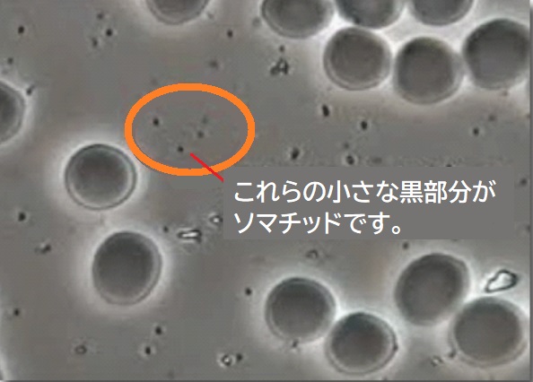 ソマチッド顕微鏡写真