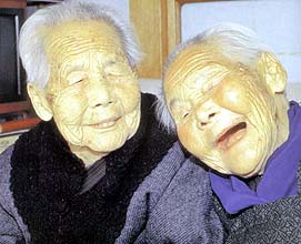 ぎん きん さん さん 100歳姉妹のきんさん・ぎんさんはアルツハイマー病だった！？